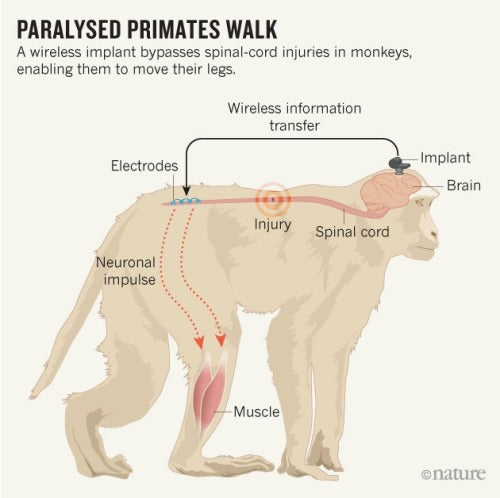 A wireless implant bypasses spinal-cord injuries in monkeys,...